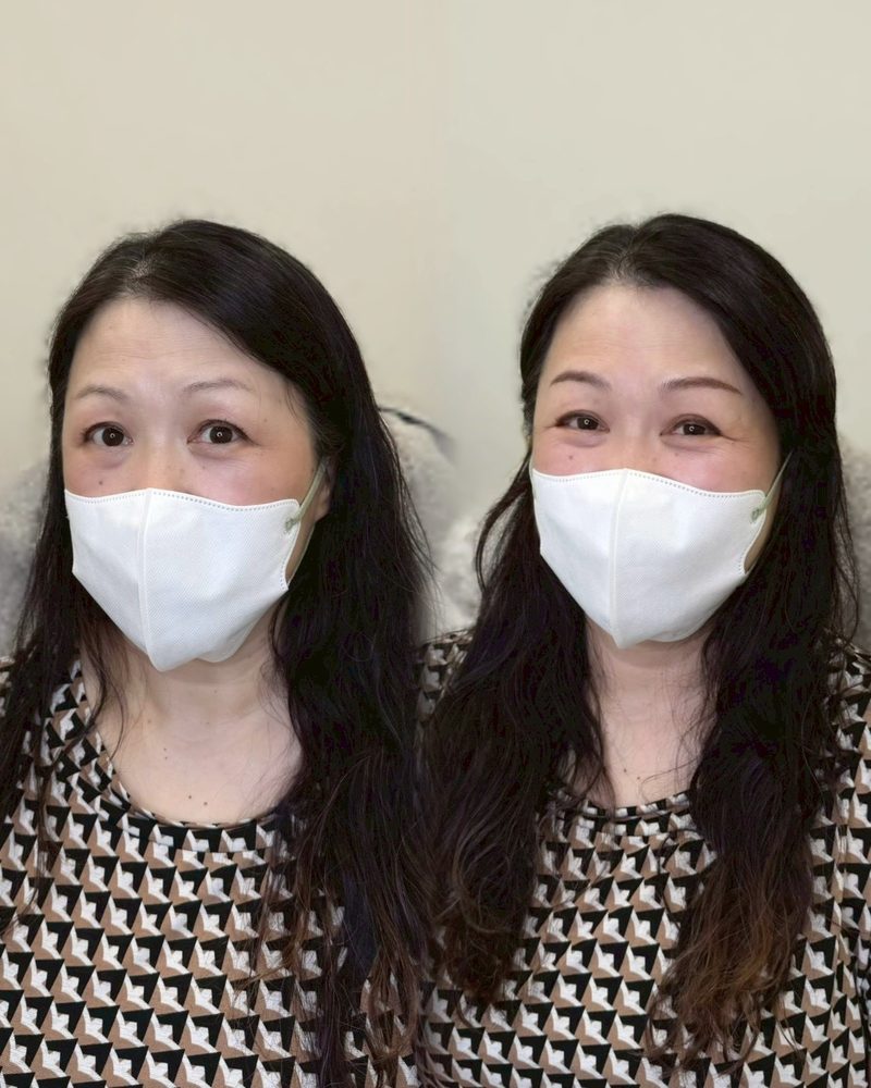 Before/After