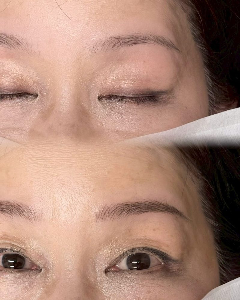 Before/After